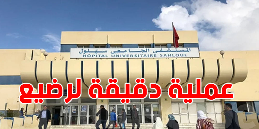شرى سارة: فريق طبّي بمستشفى سهلول ينجح في عملية دقيقة لرضيع وزنه أقل من 7 كغ