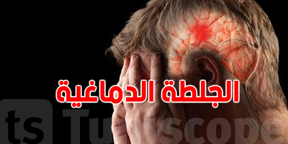عاجل : السكتة الدماغية ...كل نص ساعة إصابة وكل ساعتين وفاة في تونس