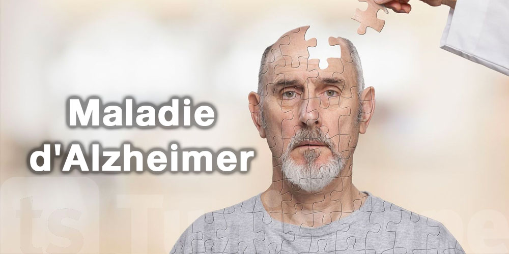10 Signes précurseurs de la maladie d'Alzheimer