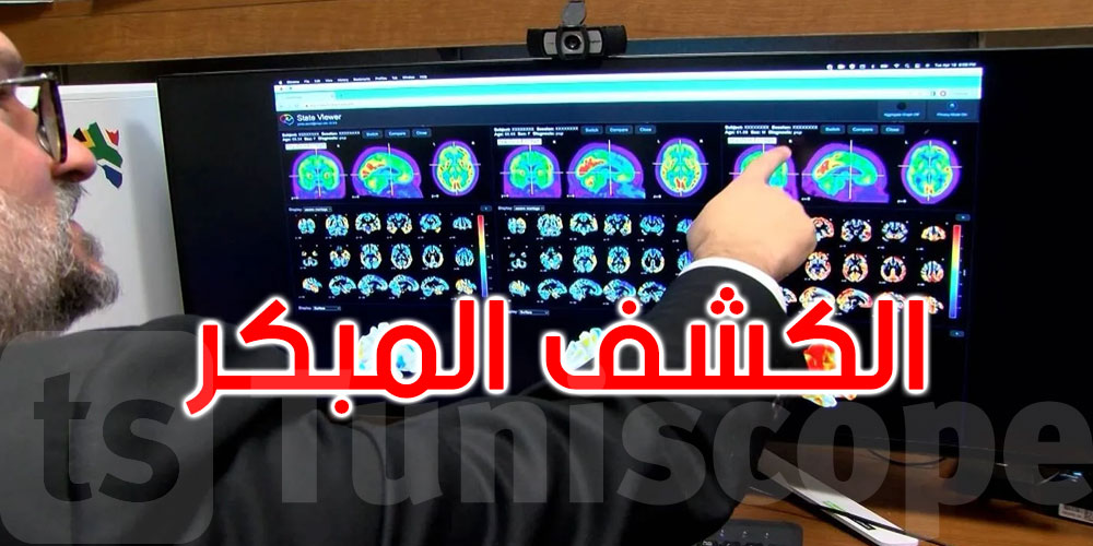   ثورة في التشخيص المبكر: تقنية تتوقع مشاكل الذاكرة قبل أن تبدأ