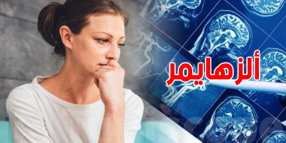تنسا في سن الـ45 : عادي ولا بداية مرض الزهايمر؟