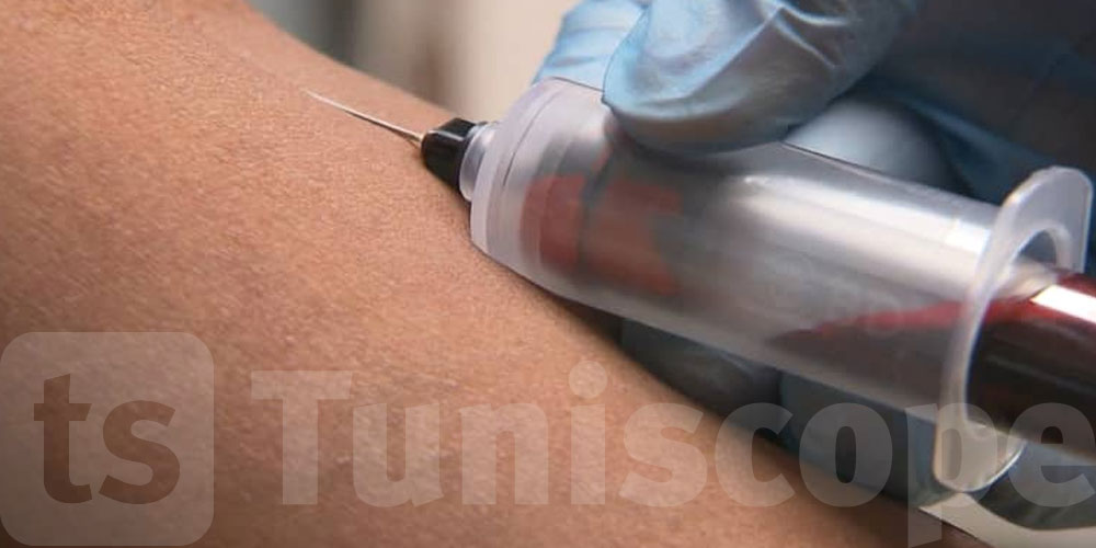 فحص دم يكشف عن الزهايمر؟!