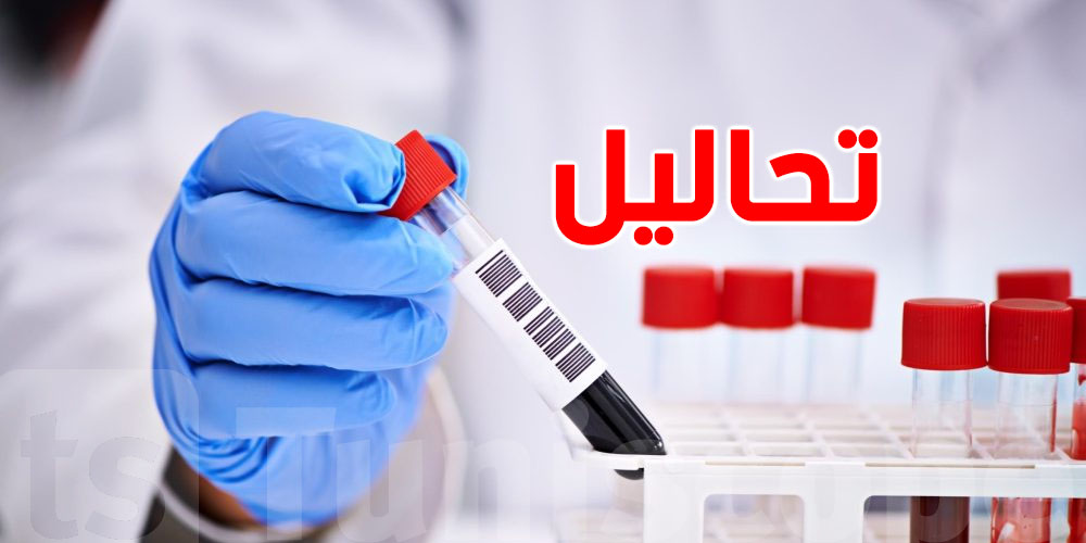 تحاليل لازم تعملهم باش تطمّن على قلبك وتبعد على أمراض القلب