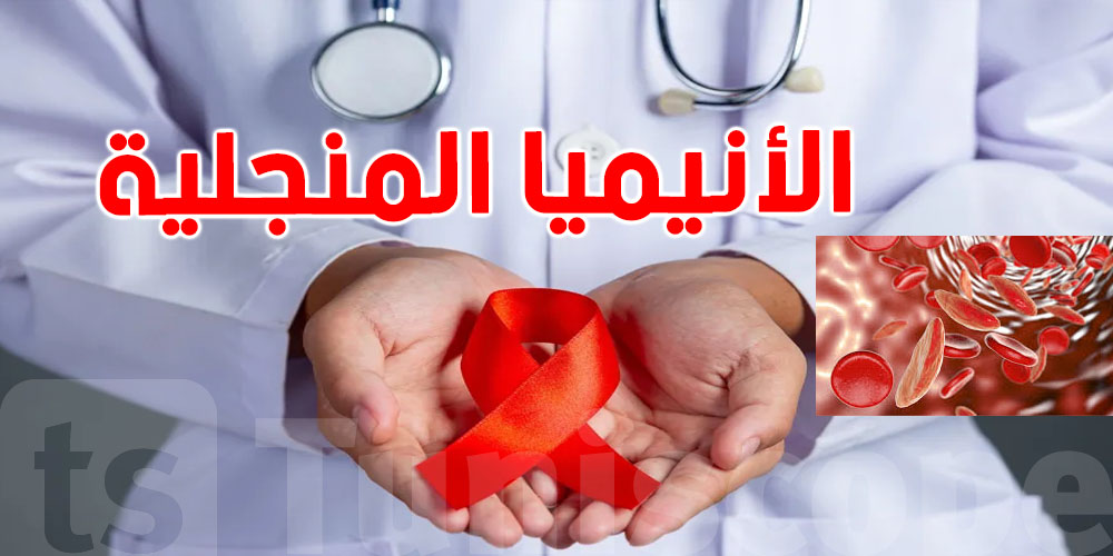   كل ما تريد معرفته عن ''الأنيميا المنجلية'' في يومها العالمي