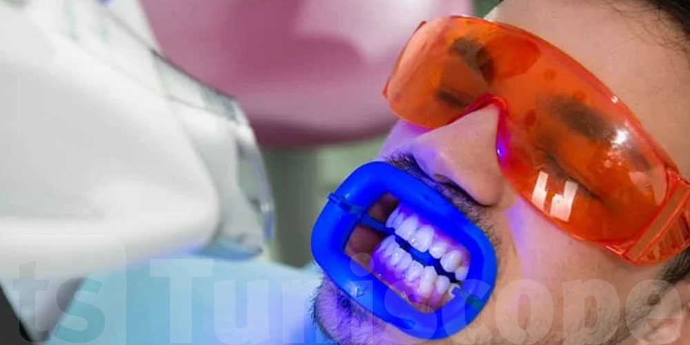 تحذير عاجل للتوانسة: تبييض الأسنان في هذه الفضاءات قد يعرّض صحتك للخطر