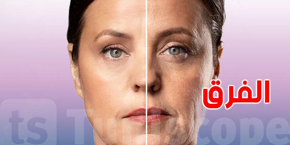 الفرق بين البوتوكس والفيلر: كل ما تحتاج معرفته قبل التجميل