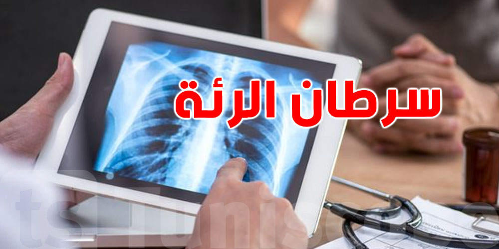 في اليوم العالمي لسرطان الرئة... هو مرض ما يرحمش أما الكشف المُبكر ينقذ حياتك