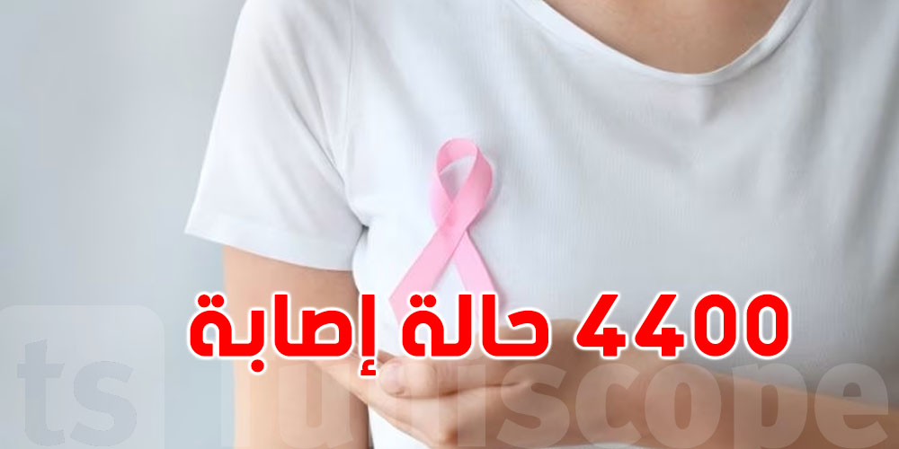 سرطان الثدي في تونس: 4400 حالة جديدة في 2024