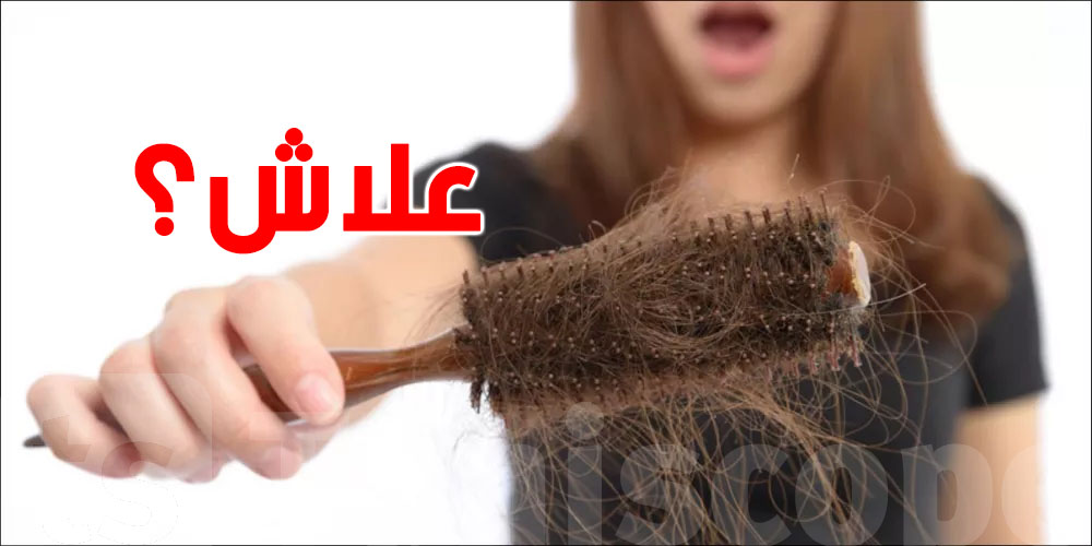 علاش شعرك يطيح؟ تحاليل لازمة باش تعرف السبب