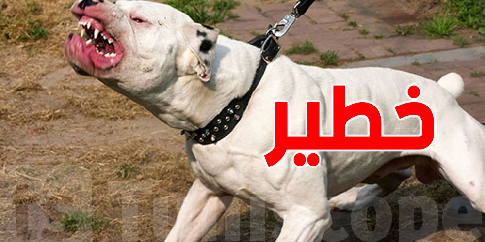 قابس: كلاب ''بيتبول'' تهاجم مواطناً وتتسبب له في إصابات خطيرة