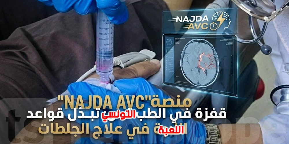 من مُستشفى عمومي في تونس: كيفاش تم إنقاذ مريض من جلطة دماغية في دقائق؟