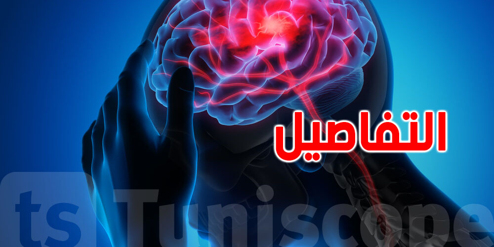 عاجل: تونس تطلق خطة وطنية لإنقاذ مرضى الجلطة الدماغية...كيفاش؟