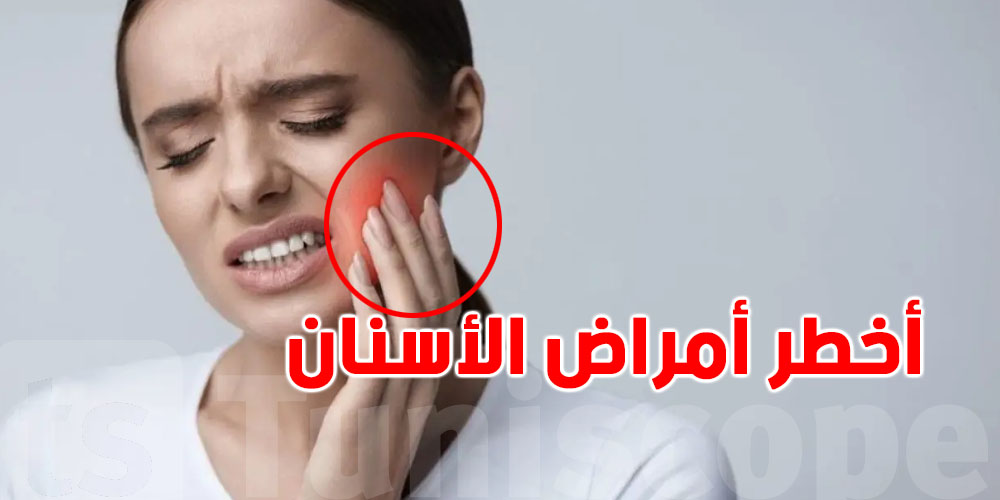 شنوّة أخطر أمراض الأسنان اللي لازم تاخو بالك منها؟