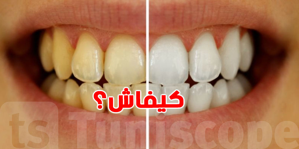 ودّع اصفرار الأسنان بدون طبيب.. الحل في كوجينتك
