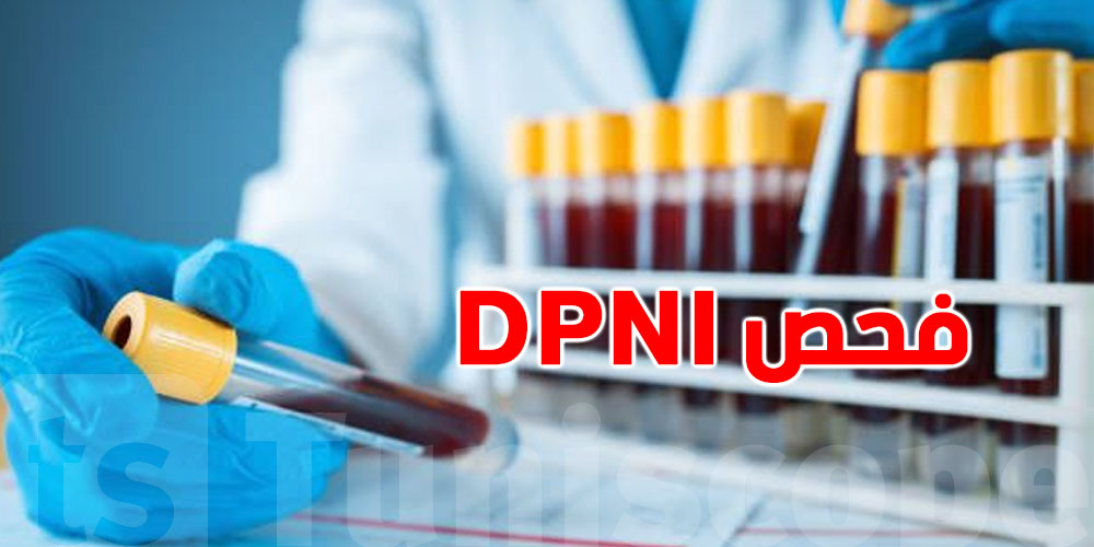 شنوة هو فحص DPNI  الي صاير عليه جدل؟للحوامل