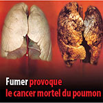 are e cigarettes bad for you Cigarette électronique : addiction, cancer... faut-il s'inquiéter du  vapotage passif ? main image 1
