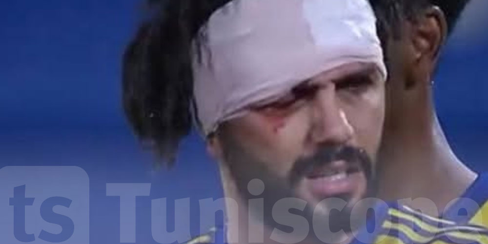 عاجل: هذه تفاصيل اصابة فرجاني ساسي