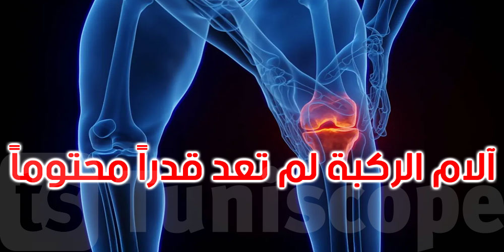 ثورة في علاج هشاشة المفاصل: قسطرة الشريان الركبي تنجح في تخفيف الألم المزمن