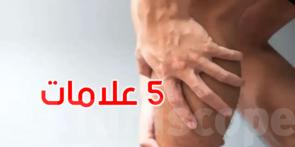 5  علامات على ساقيك قد تشير إلى ضعف الدورة الدموية... اكتشفها