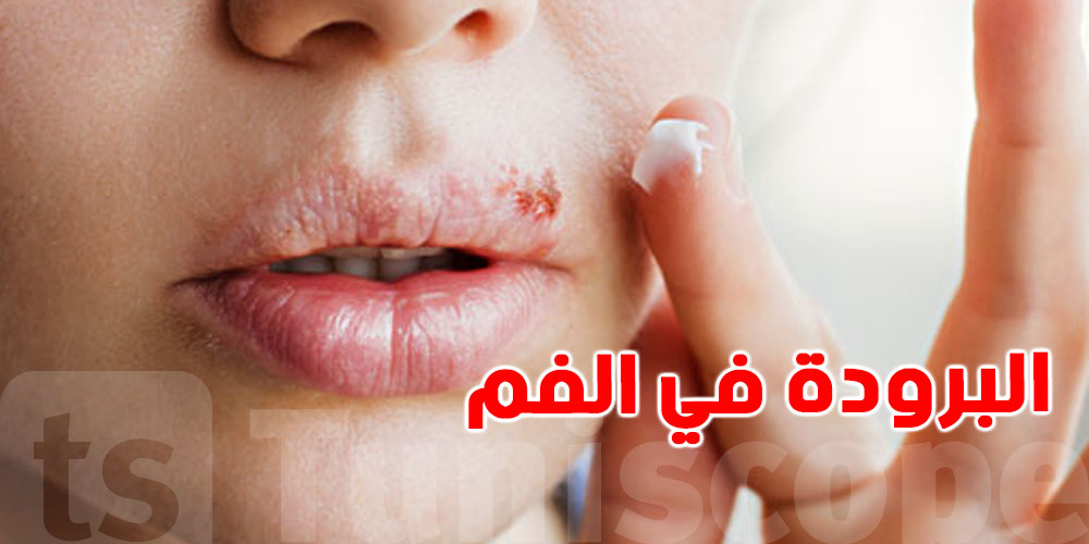 برودة الفم: فيروس صغير يخبي وراه مشكل كبير؟