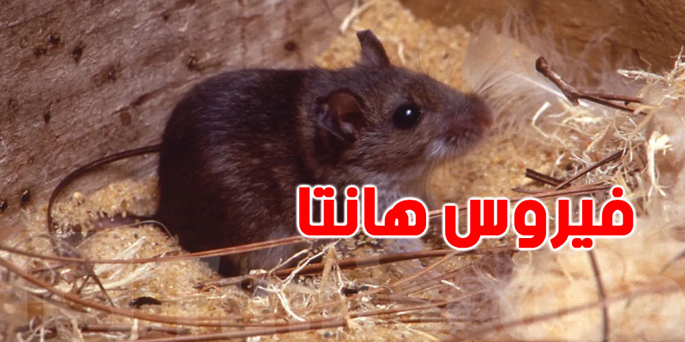 ثبوت إصابة كندي بفيروس ''هانتا''