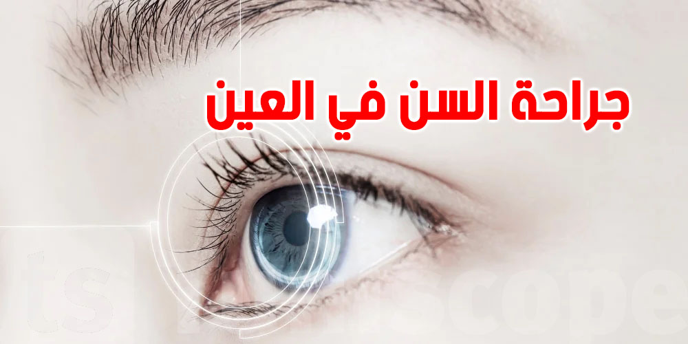 إجراء طبي ثوري يستخدم أسنان المريض لإعادة الرؤية: شنيا الحكاية؟