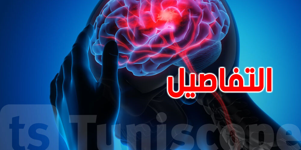 انطلاق المخطط الوطني للتكوين حول الجلطة الدماغية (AVC)