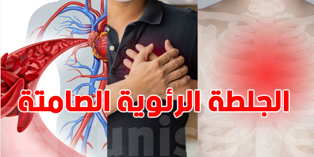 هام: وفاة نجمة هوليوود تكشف خطر الجلطة الرئوية الصامتة