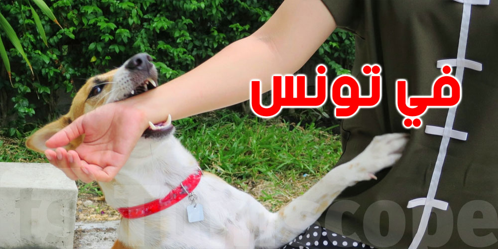 تونس: وفاة الطفل المصاب بداء الكلب