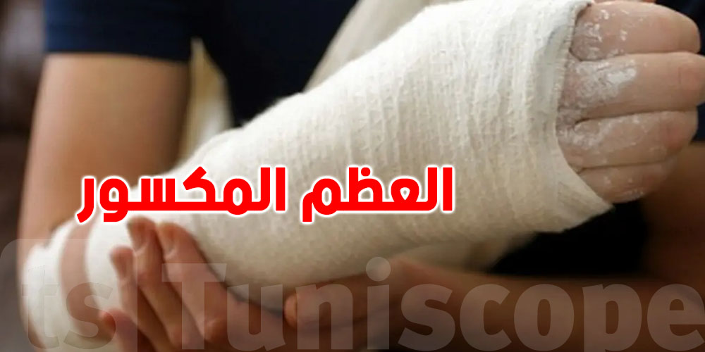 الجبيرة: من شنوّا متكوّنة وكيفاش تحافظ عليها؟