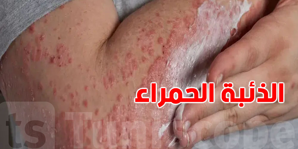 مرض خطير يبدأ بأعراض بسيطة… انتبه منها!