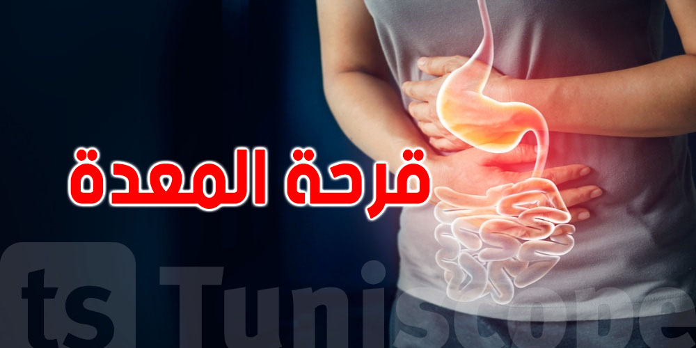 قرحة المعدة: شنوة تاكل وشنوة لا؟