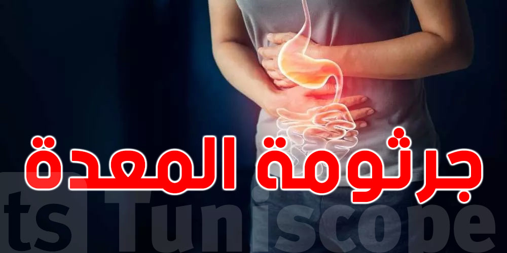 4 خرافات متداولة عن جرثومة المعدة.. علاش تتكرر الإصابة؟