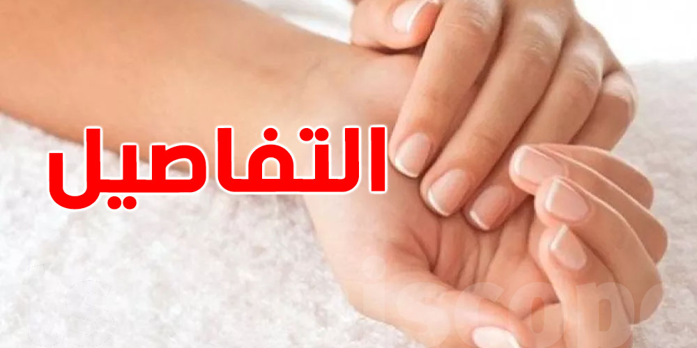 لا تتجاهلها..علامة في يديك قد تدل على هذا المرض