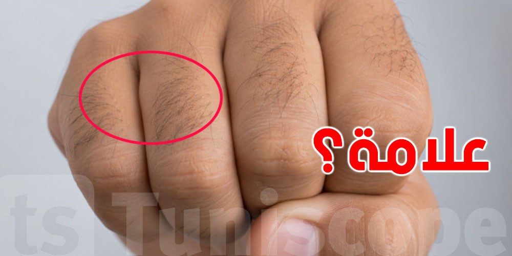 الشعر على أصابع اليدين والقدمين...يحمل اشارات على الحاجة هذه