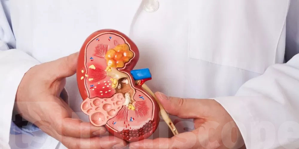 9% من التوانسة مصابين بأمراض الكلى 