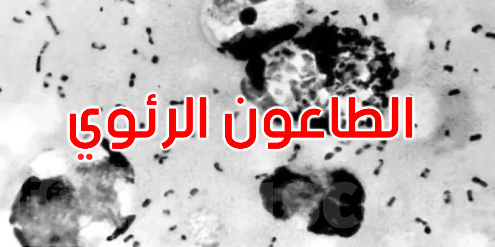 بعد الاشتباه بوفاة باحثة روسية بسببه... ماذا نعرف عن الطاعون الرئوي؟