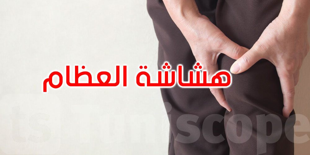 نحو استراتيجية وطنية للتكفل بمرض هشاشة العظام