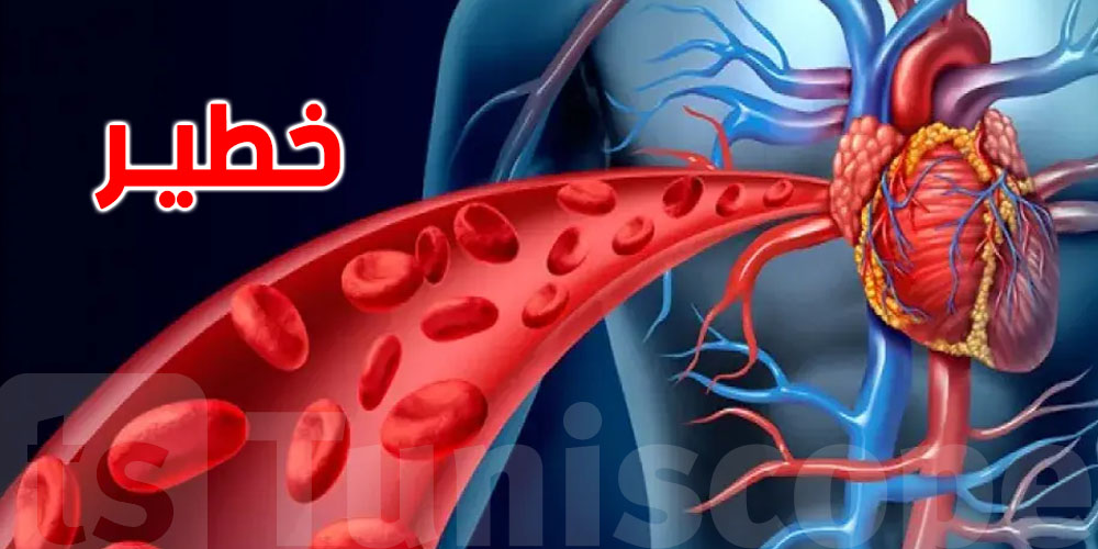 أطبّاء تونسيون يكشفون الأسباب الأولى للوفاة