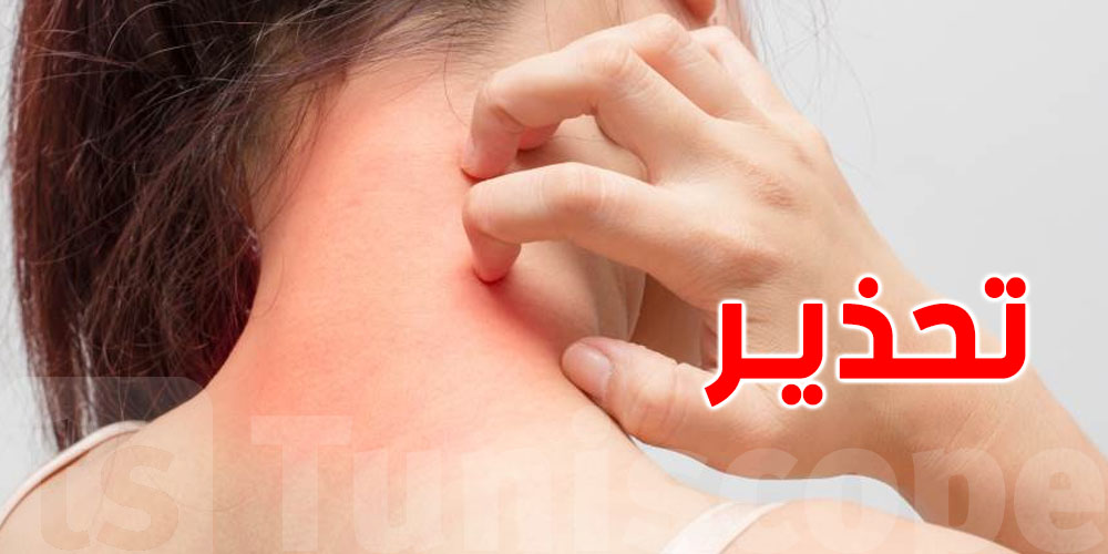 طبيبة تونسية تحذّر من التعرّي في الشواطئ: خطر صيفي حقيقي يهدّد صحتنا وصحة صغارنا!