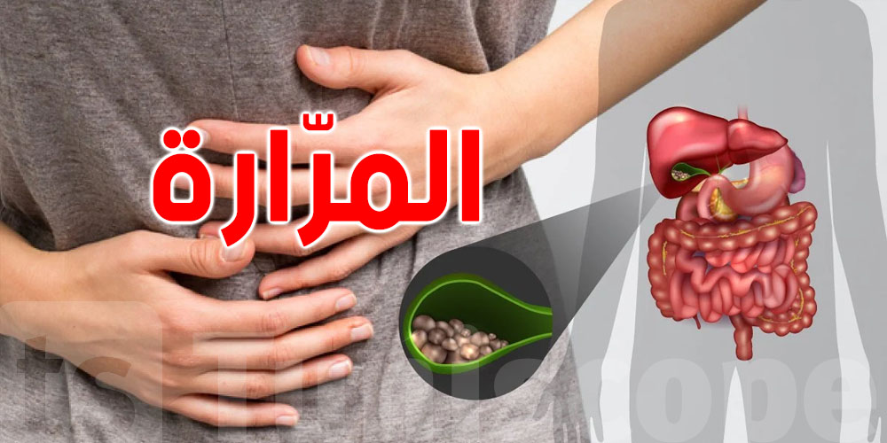 د. أسامة بركات: حجر المرّارة ما يتفتّتش…والحلّ الوحيد هو استئصالها!