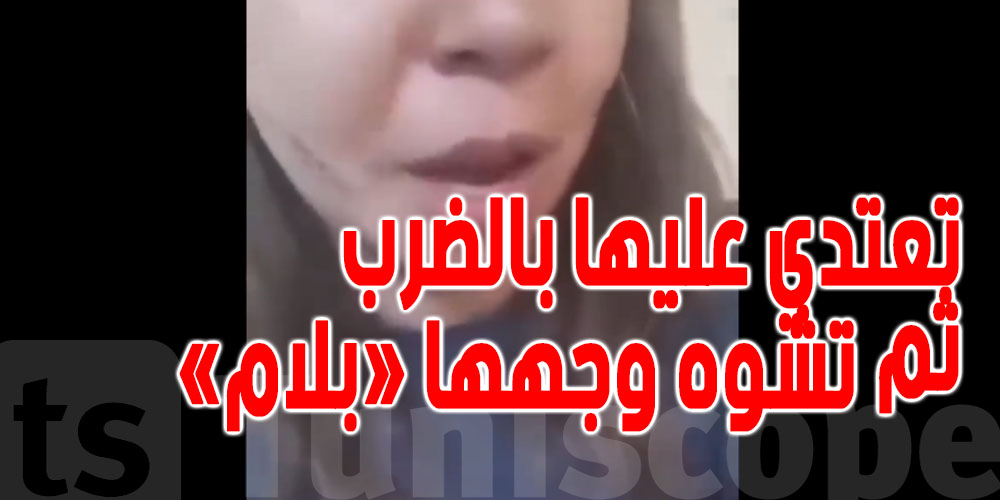 عاجل - المنيهلة : فتاة تتعرض للضرب ثم التشويه ''بالة حادة'' من قبل جارة و ابنتها .... 