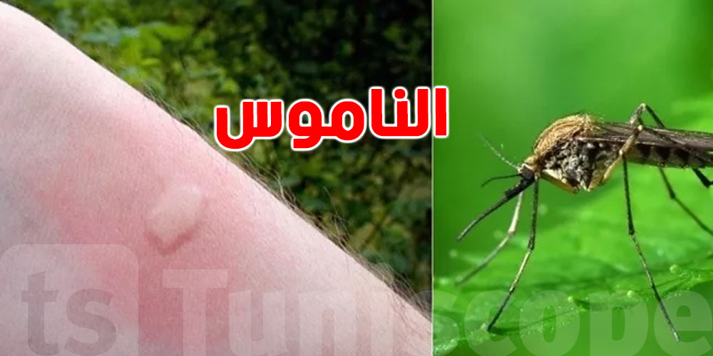 طبيب يحذر ''قرصة الناموس'' أصبحت خطرًا على التونسيين خاصة الأطفال