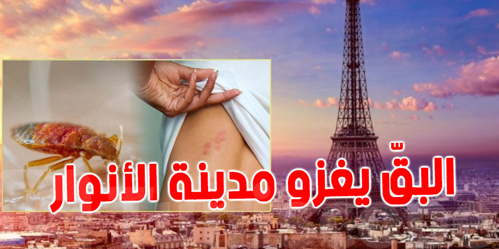 البق في فرنسا :  دولة عربية تنطلق في أخذ الاحتياطات ...من هي ؟