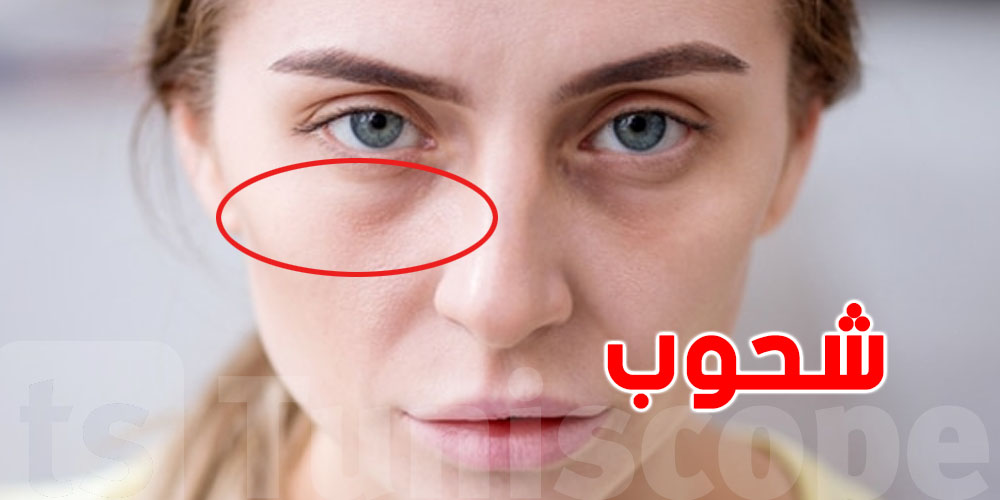 بشرتك شاحبة في رمضان؟ هكّا ترجع الإشراقة بسرعة