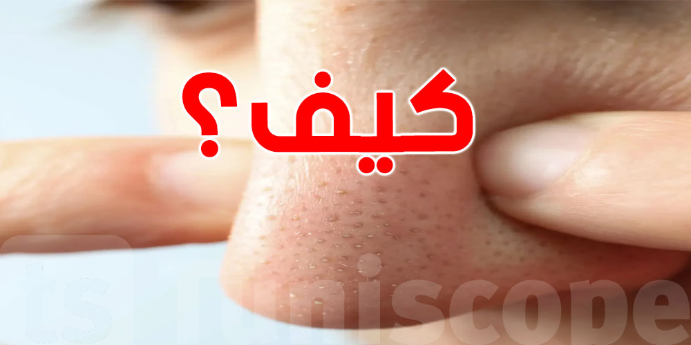 خطوة بخطوة: كيفاش تنحّي الرؤوس السوداء بلاش ضرر لبشرتك؟