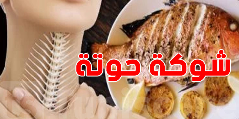 بلعت شوكة حوتة؟...هالطريقة الشعبية تنجم تزيدك في الخطر..شتعمل؟