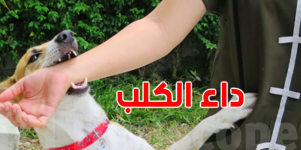 لقاح الكلب يحمي الأرواح.. حالة وفاة وحيدة بداء الكلب في 2025