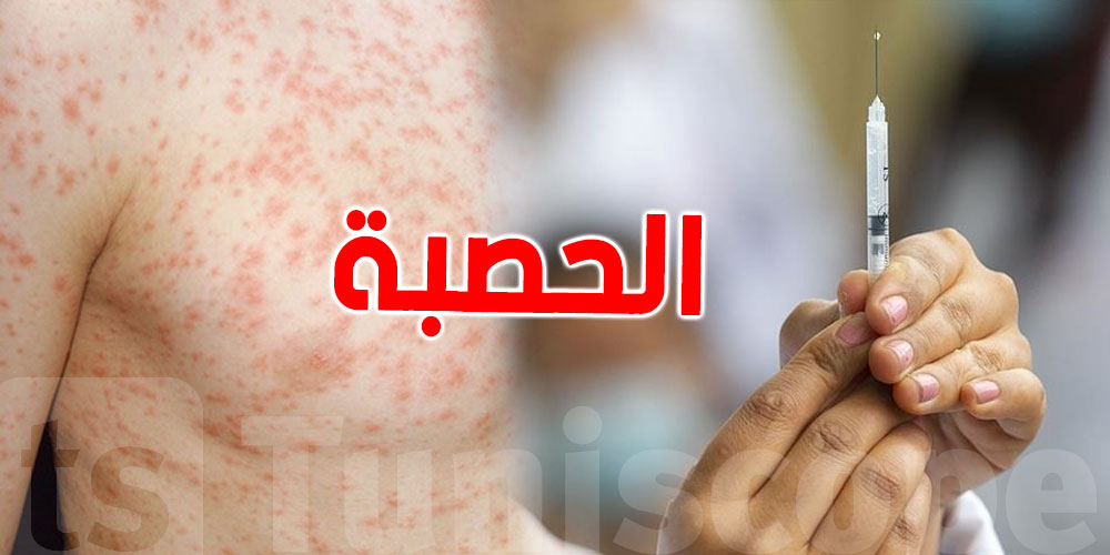 علاش الصغير يُمرض بالحصبة رغم انه ملقّح؟