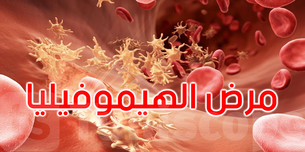 شراكة دوليّة لتحسين رعاية مرضى الهيموفيليا